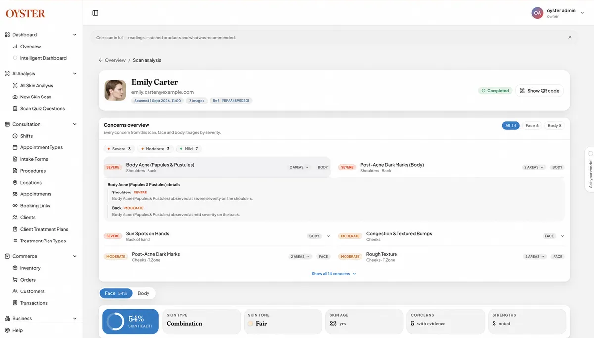 Illustrative Oyster scan report with example account, concern cards and skin summary
